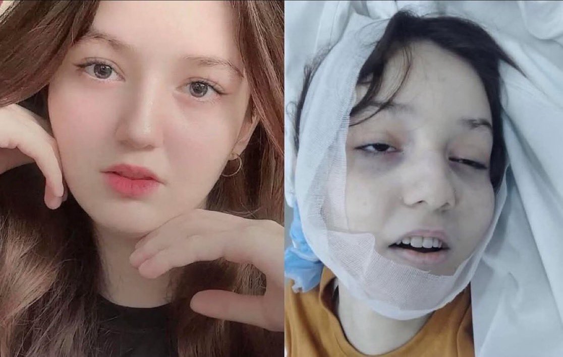 🚨🇵🇰BREAKING:

A 17-year-old girl who shared posts advocating for women's rights in Pakistan was killed by a relative.