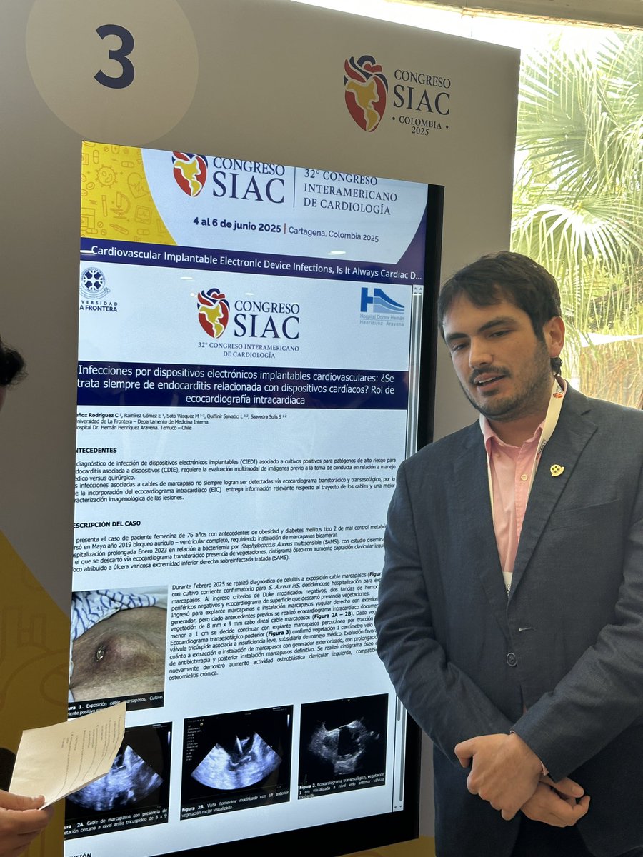 Luis Quininir, MD ECES FACC 🇨🇱 (@fellowep) on Twitter photo <a href="/SIAC_cardio/">SIAC</a>
Dr. Carlos Muñoz, residente del programa Cardiología <a href="/UFrontera/">UFRO</a> <a href="/medufro/">Fac. Medicina UFRO</a> presentando nuestra experiencia con el
uso de Ecografía Intracardiaca en extracciones de dispositivos y endocarditis.
<a href="/Sochicaroficial/">Soc. Chilena de Cardiología</a> <a href="/MauroSotoMD/">Mauricio Soto V, MD, MSc, FACC 🇨🇱</a>
Felicitaciones! <a href="/SIAC_cardio/">SIAC</a>
Dr. Carlos Muñoz, residente del programa Cardiología <a href="/UFrontera/">UFRO</a> <a href="/medufro/">Fac. Medicina UFRO</a> presentando nuestra experiencia con el
uso de Ecografía Intracardiaca en extracciones de dispositivos y endocarditis.
<a href="/Sochicaroficial/">Soc. Chilena de Cardiología</a> <a href="/MauroSotoMD/">Mauricio Soto V, MD, MSc, FACC 🇨🇱</a>
Felicitaciones!