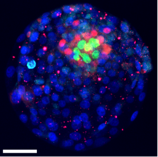 StanStrawbridge's tweet image. 1/10🧵New preprint! 🚀
We built a resource of 20 clonal human naïve pluripotent stem cell lines from 10 blastocysts. Explore embryo-to-embryo and clone-to-clone variation in one place.
👉doi.org/10.1101/2025.0…