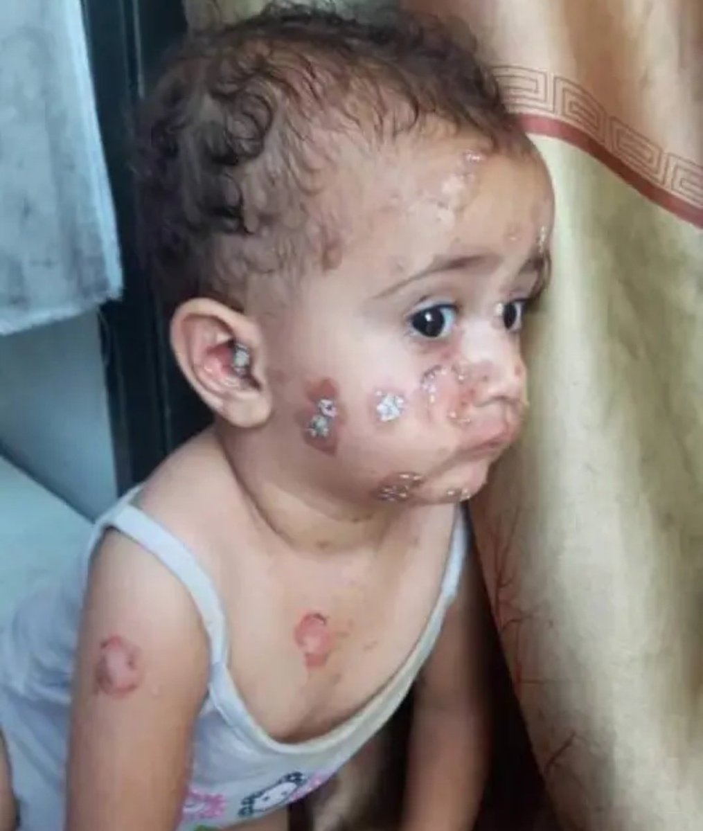 If u see this pretty angel, reply with 💔🇵🇸 Pray for her.💔