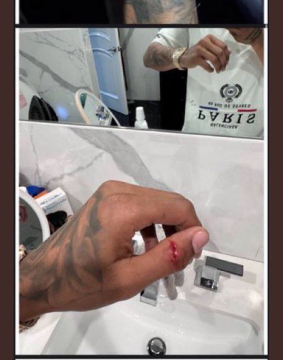 In 1 of the 165 Documents DDG revealed to the court it shows that Halle Bailey STABBED Ddg in the hand 

DDG was the Victim all along smh