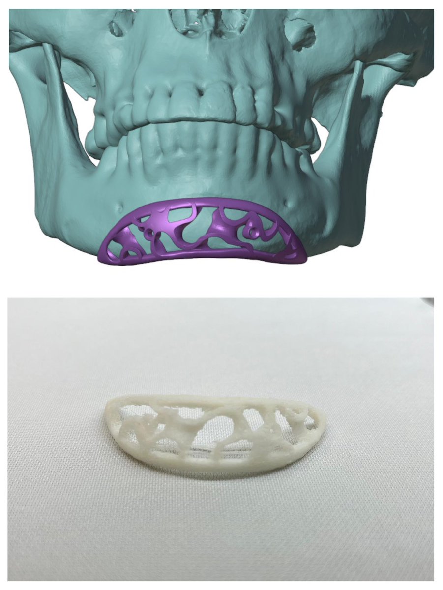 Od świata wirtualnego do realnego.
A zabieg operacyjny już wkrótce. 🙏