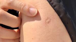 to buy tickets for the con in brazil you need to present this mark  !!