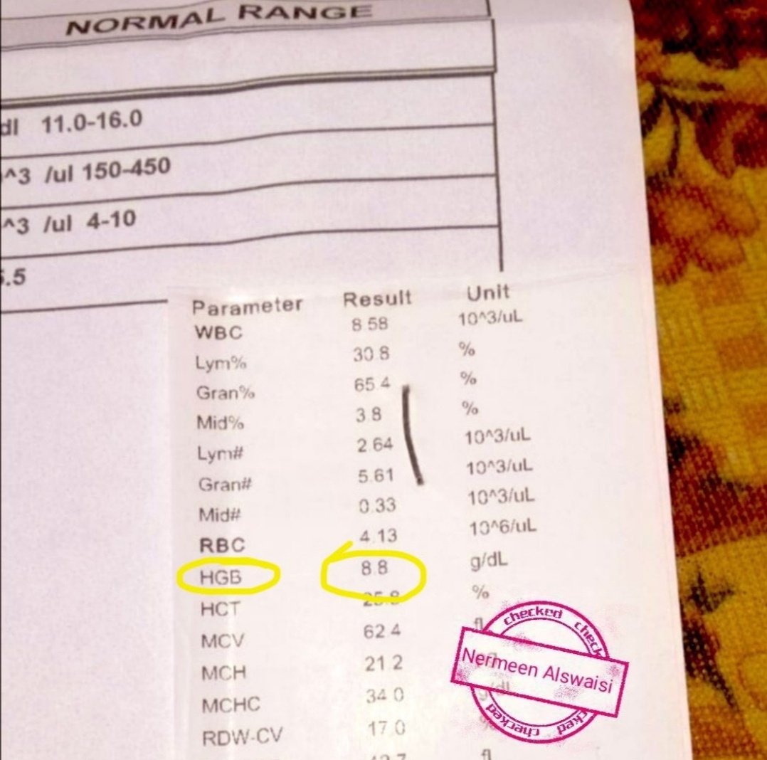 Urgent humanitarian appeal 🚨

I suffer from anaemia due to malnutrition, and I feel dizzy. My health is getting worse, and my hair is falling out. The doctor said I need iron, vegetables and meat, but there is nothing just iron tab.
No food no water 💔

chuffed.org/project/nermeen