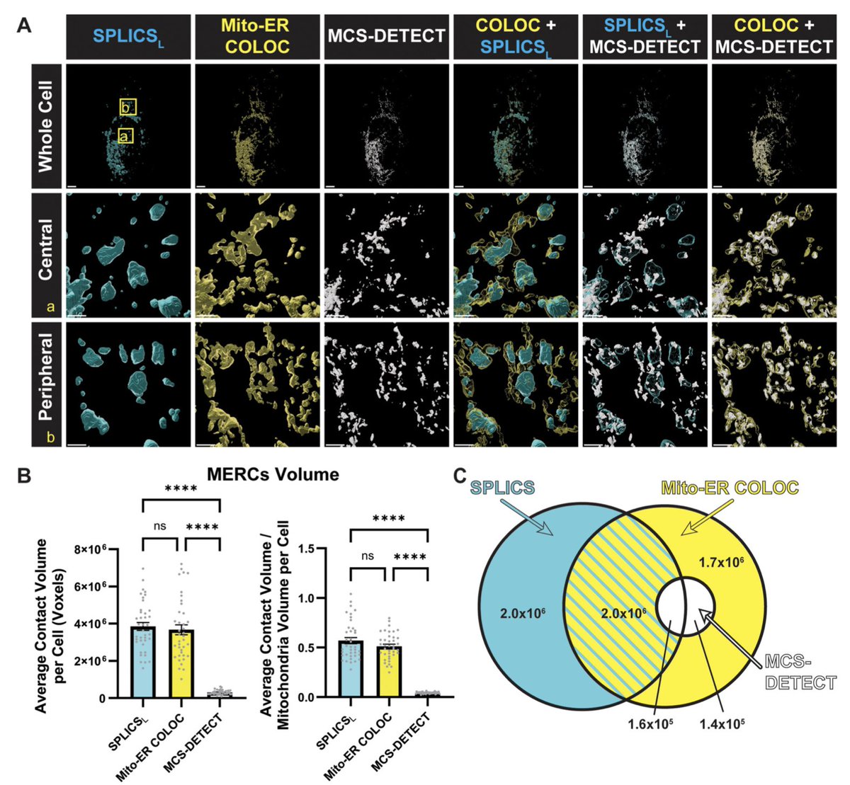 Hamarneh_MIA's tweet photo. New  paper in 'Contact: The Journal of Inter-Organelle Communication' on "Comparative Analysis of SPLICS and MCS-DETECT for Detecting Mitochondria-ER Contact Sites (MERCs)".  Collaboration between @SFU_CompSci and UBC Life Sciences Institute.

📄 https://t.co/MoMcY1qV15 https://t.co/dO5QRW2aOl