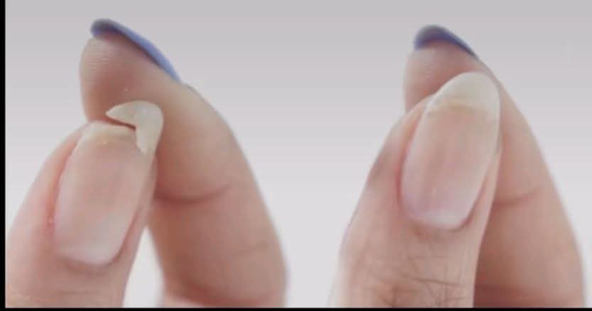 البنت تنزل صورة لظفرها المكسور ويجيها 300 واحد بثانية يقولها الحمدلله على سلامتك

وانا قبل فتره سويت حادث وصورة سيارتي متقلبه رد عليا واحد اذا باتبيع التواير كلمنا
😁شعب لا احساس ولا ضمير 😌