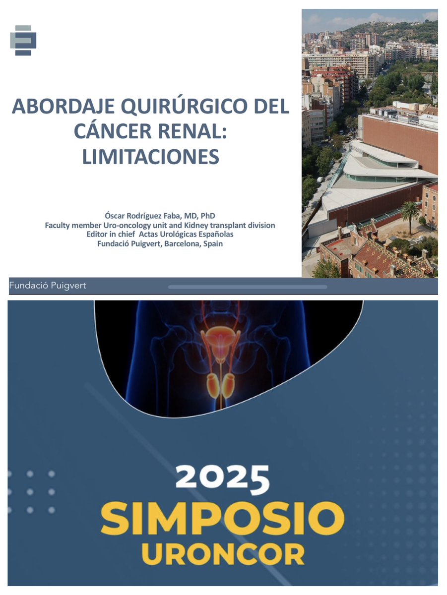 Un placer participar en #URONCOR2025 en la mesa de cáncer renal. Gran oportunidad para debatir con los colegas oncólogos radioterapeutas sobre tumores urológicos.