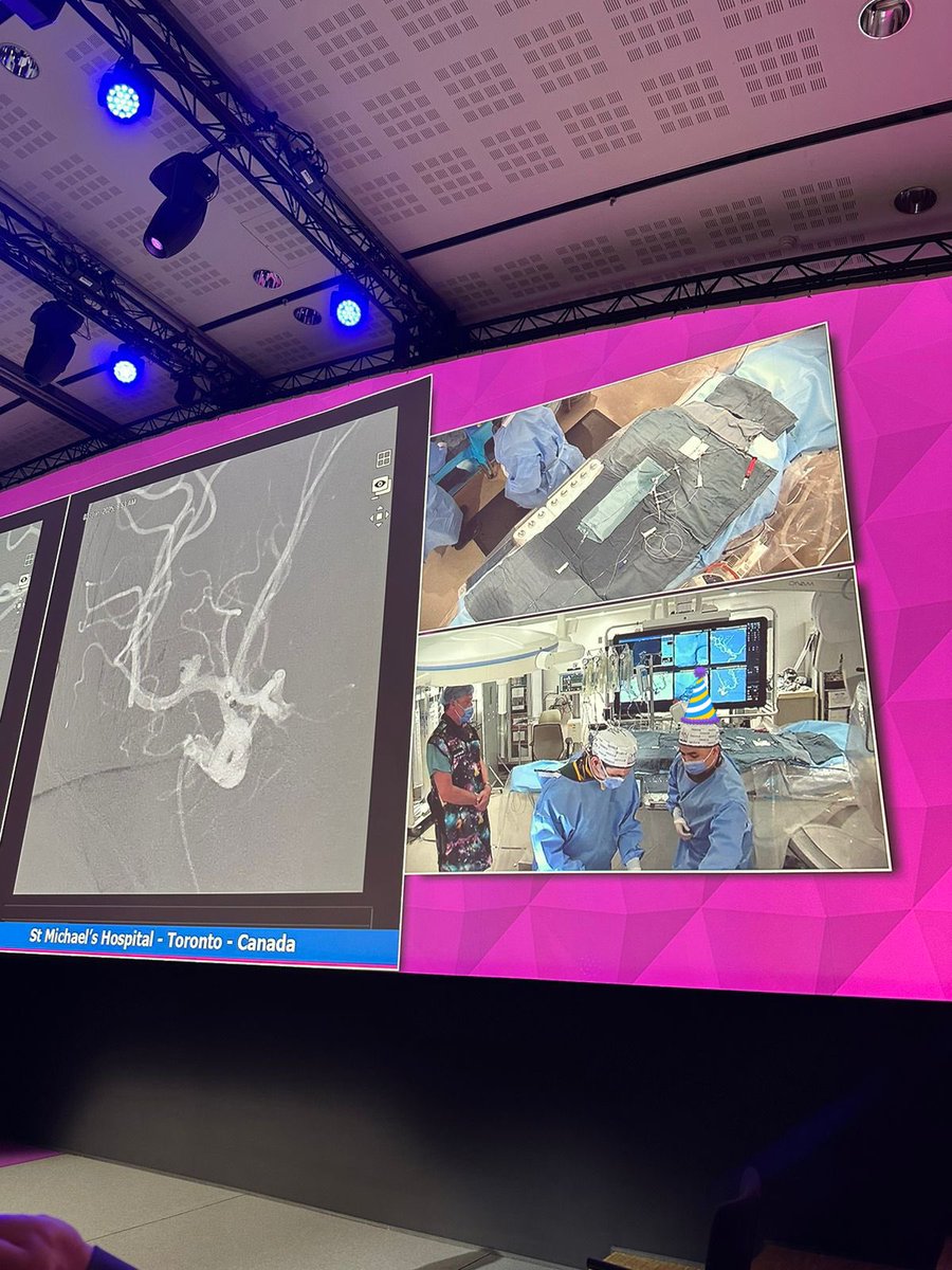 Dr. DiestroKE (@dannidiestro) on Twitter photo A neurologist born & raised in the Philippines—now on one of the biggest stages in the neuroendovascular field! 🙌🇵🇭 <a href="/LINNConline/">LINNC online 🧠</a> #LINNC2025 Grateful to the best INR team <a href="/SmhNeuroVasc/">Neurovascular Center @ St. Michael's Hospital</a> 🇨🇦 for the mentoring & support <a href="/vitorpereiracan/">Vitor Mendes Pereira</a> <a href="/trmarot/">Tom Marotta</a> + Julian Spears <a href="/UofT_DoM/">Department of Medicine University of Toronto</a> <a href="/UofTMedIm/">UofT Medical Imaging</a> A neurologist born & raised in the Philippines—now on one of the biggest stages in the neuroendovascular field! 🙌🇵🇭 <a href="/LINNConline/">LINNC online 🧠</a> #LINNC2025 Grateful to the best INR team <a href="/SmhNeuroVasc/">Neurovascular Center @ St. Michael's Hospital</a> 🇨🇦 for the mentoring & support <a href="/vitorpereiracan/">Vitor Mendes Pereira</a> <a href="/trmarot/">Tom Marotta</a> + Julian Spears <a href="/UofT_DoM/">Department of Medicine University of Toronto</a> <a href="/UofTMedIm/">UofT Medical Imaging</a>