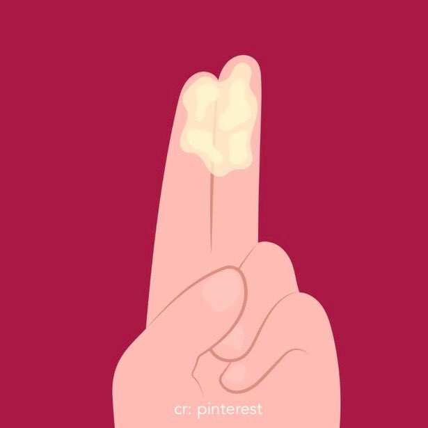 linskinjournal's tweet image. for ladies: vaginal health is EVERYTHING.

so, aku mau share tips &amp;amp; tricks yg udah aku lakuin biar area miss v tetap sehat… nggak bau busuk… dan terhindar dari keputihan abnormal.

aku jelasin pakai bahasa bayi ya.