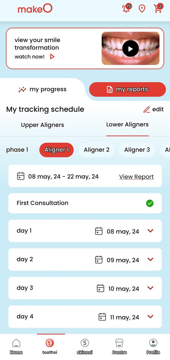 Udayzone909's tweet image. Paid a huge amount to @makeOtoothsi expecting expert dental care. But got poor treatment from junior dentists. Still suffering with pain and tooth gaps again. No proper support from their team. Attaching photos as proof. #Toothsi #MakeO #DentalNegligence