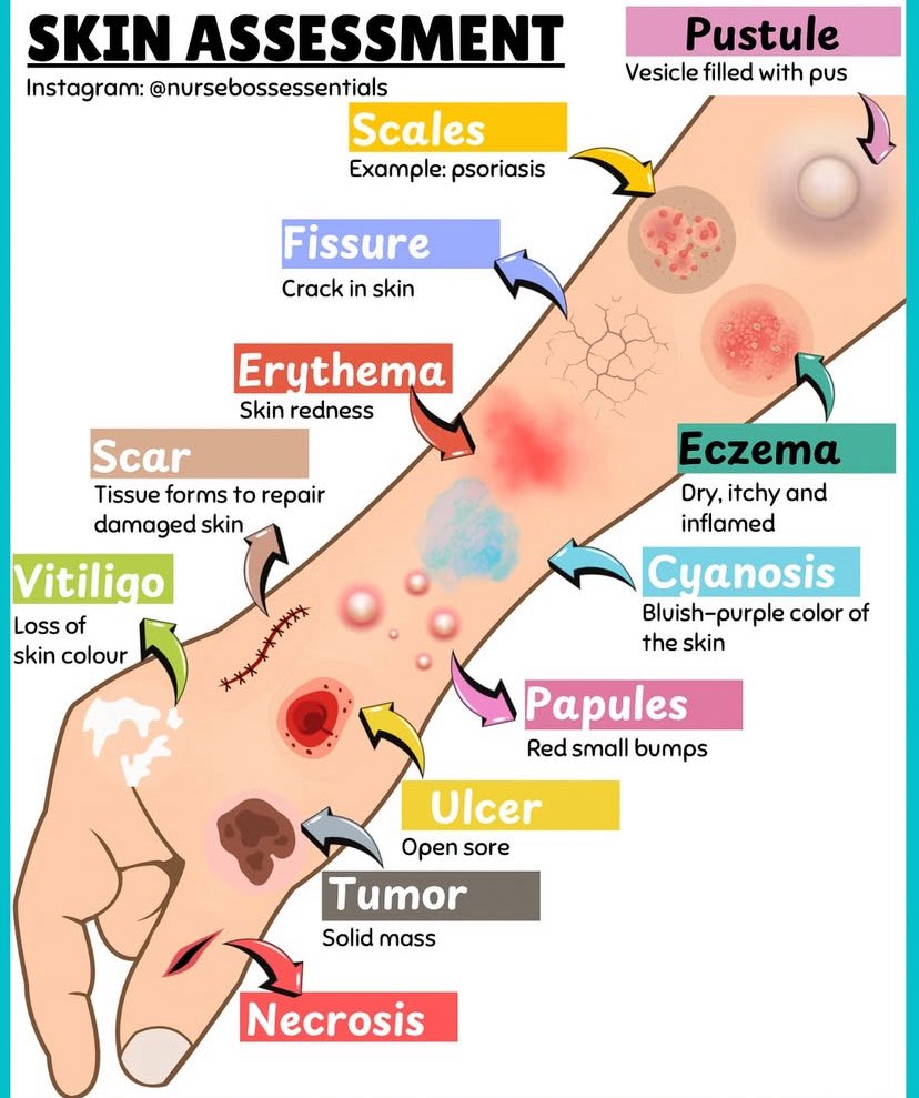 SKIN ASSESSMENT

#Nursing