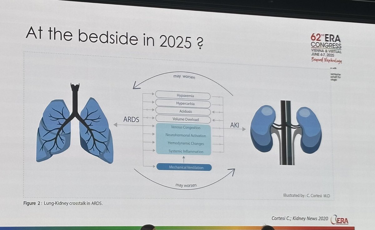 Martina Baiardo Redaelli (@baiardomartina) on Twitter photo At #ERA25 the cross-talk between lung and kidney in ARDS
➡️bidirectional 🫁🫘
➡️ high clinical relevance
➡️need for tailored therapeutic targets in a heterogeneous syndrome
🔗 pmc.ncbi.nlm.nih.gov/articles/PMC11…
🔗 pubmed.ncbi.nlm.nih.gov/31820034/
<a href="/ERAkidney/">ERA - European Renal Association</a> At #ERA25 the cross-talk between lung and kidney in ARDS
➡️bidirectional 🫁🫘
➡️ high clinical relevance
➡️need for tailored therapeutic targets in a heterogeneous syndrome
🔗 pmc.ncbi.nlm.nih.gov/articles/PMC11…
🔗 pubmed.ncbi.nlm.nih.gov/31820034/
<a href="/ERAkidney/">ERA - European Renal Association</a>