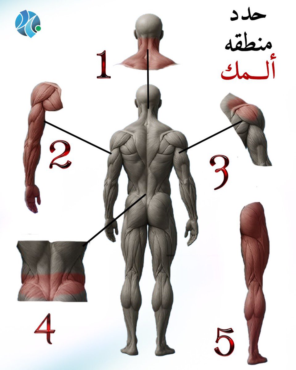 حدد منطقة ألمك لنساعدك في العلاج
