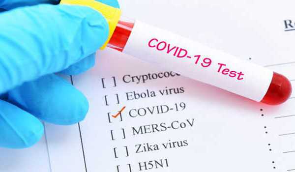 Covid-19 spike continues: 4,866 active cases, infant among 7 more deaths goachronicle.com/covid-19-spike…