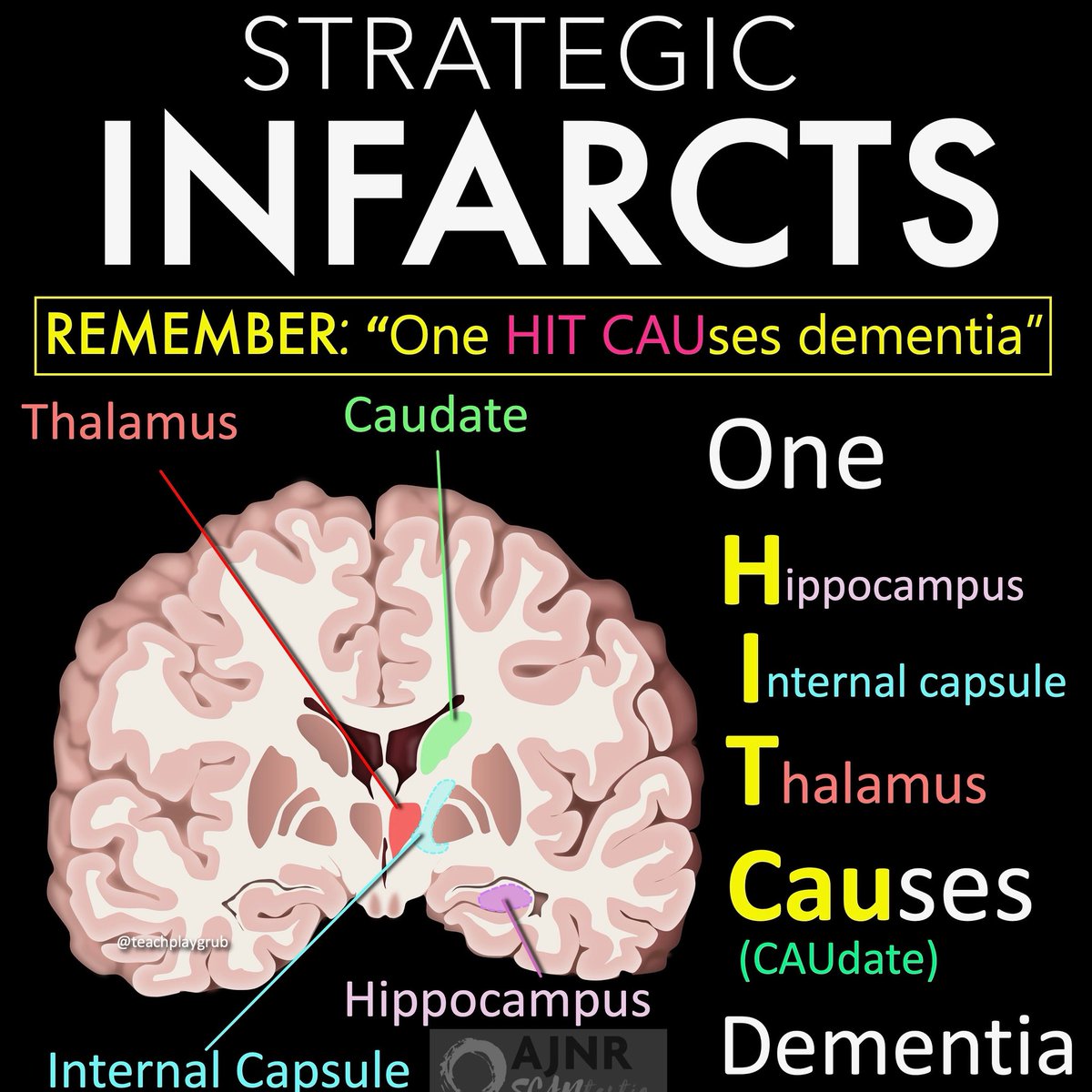 Having trouble remembering what to look for in vascular dementia on imaging?
 
Almost everyone w/memory loss has infarcts. Which are important?
 
The latest @theajnr has what you need to know:
 
ajnr.org/content/46/5/1…
 
Strategic infarcts are infarcts located in structures