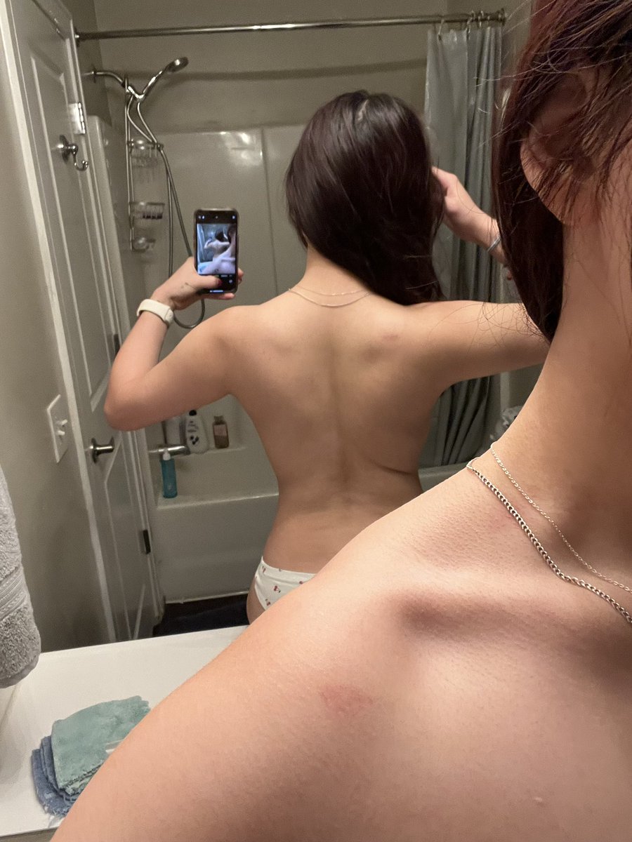 strvngbvny's tweet photo. why is my back so Strange looking https://t.co/XXVbawLfSz