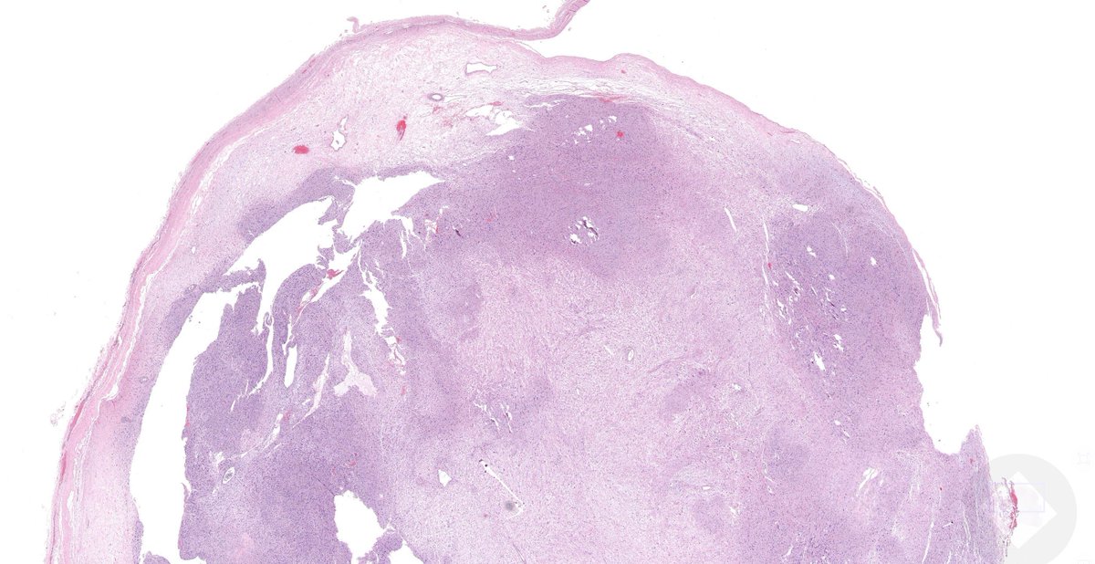 Jerad Gardner, MD tweet media