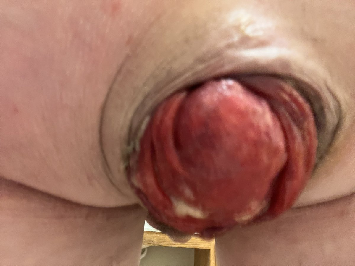 𝐁𝐥𝐨𝐧𝐝𝐢𝐞 tweet media