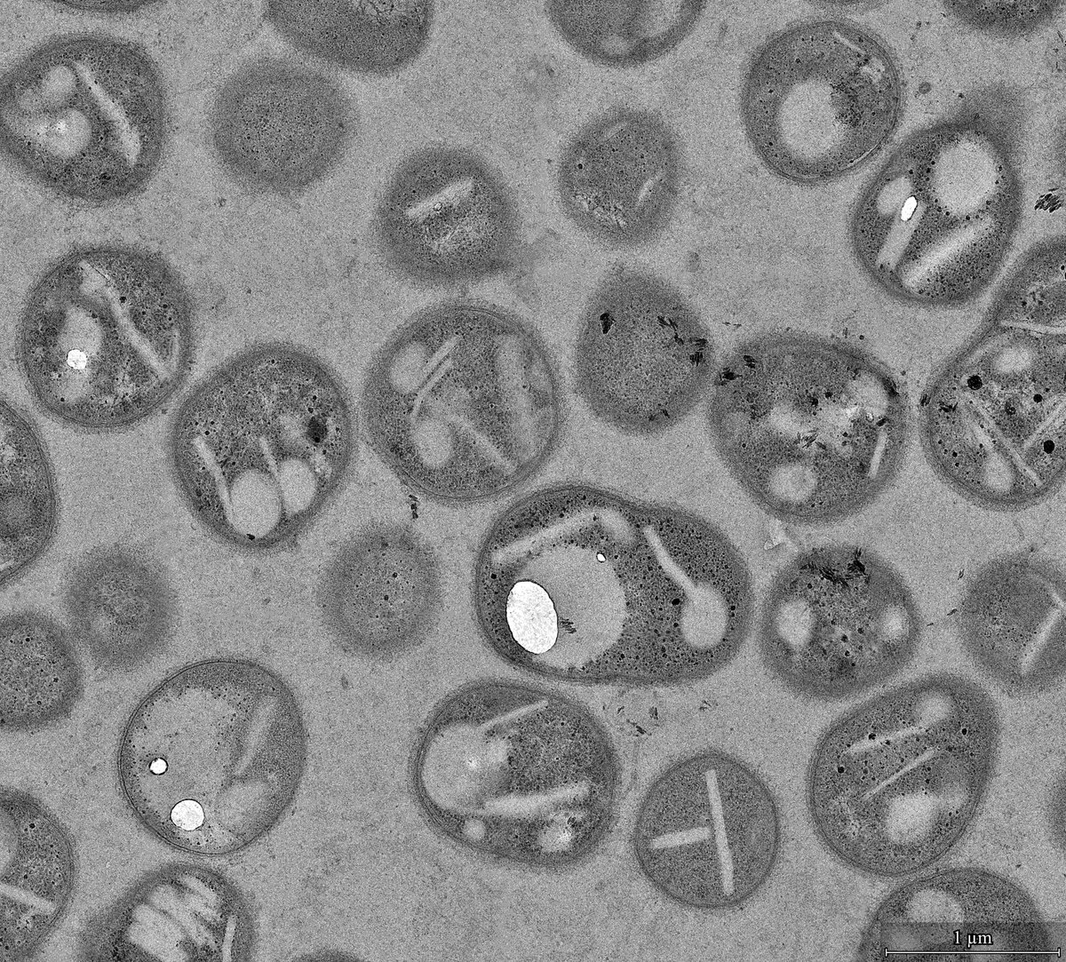 CIB Margarita Salas (CSIC) (@cib_csic) on Twitter photo La Fundacion Reina Sofía, el <a href="/CSIC/">CSIC</a> y la Fundación Primafrio, colaboran en la investigación en Biotecnología para la gestión sostenible de plásticos.
El proyecto BIO-PLACE complementa a ReCREA, desarrollado en el <a href="/CIB_CSIC/">CIB Margarita Salas (CSIC)</a> por la Dra Isabel Pardo.
🔗cib.csic.es/es/news/invest… La Fundacion Reina Sofía, el <a href="/CSIC/">CSIC</a> y la Fundación Primafrio, colaboran en la investigación en Biotecnología para la gestión sostenible de plásticos.
El proyecto BIO-PLACE complementa a ReCREA, desarrollado en el <a href="/CIB_CSIC/">CIB Margarita Salas (CSIC)</a> por la Dra Isabel Pardo.
🔗cib.csic.es/es/news/invest…