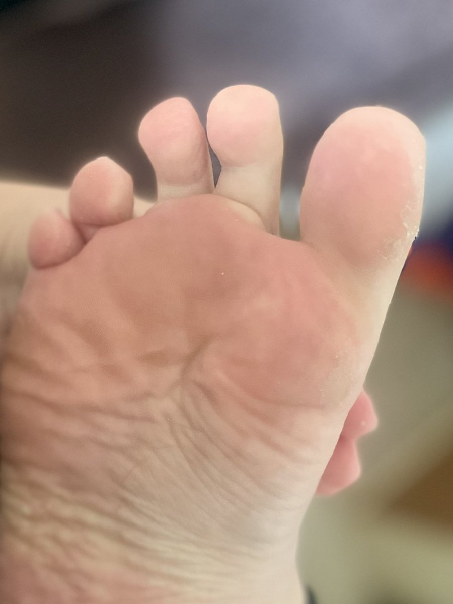 Freshly Showered Toes… in need of some extra pampering since it’s 🩸 week! 

Findom | findom uk | paypig | paypig pedicure | finsub