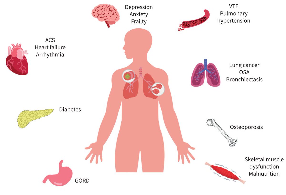 Understanding chronic #respiratory diseases as a #multisystem disease guides better diagnosis and care. 

The additive effect of these comorbidities has a detrimental effect on patients with chronic respiratory #diseases in terms of mortality, exacerbation frequency, symptom