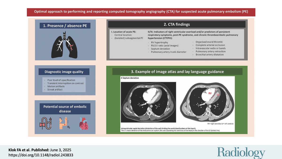Pulmonary embolism protocols got you second-guessing? 🫁💡This new consensus statement offers a practical guide to performing and reporting CTA for suspected PE, backed by major societies in radiology and cardiology. A must-read for refining your approach:
pubs.rsna.org/doi/10.1148/ra…