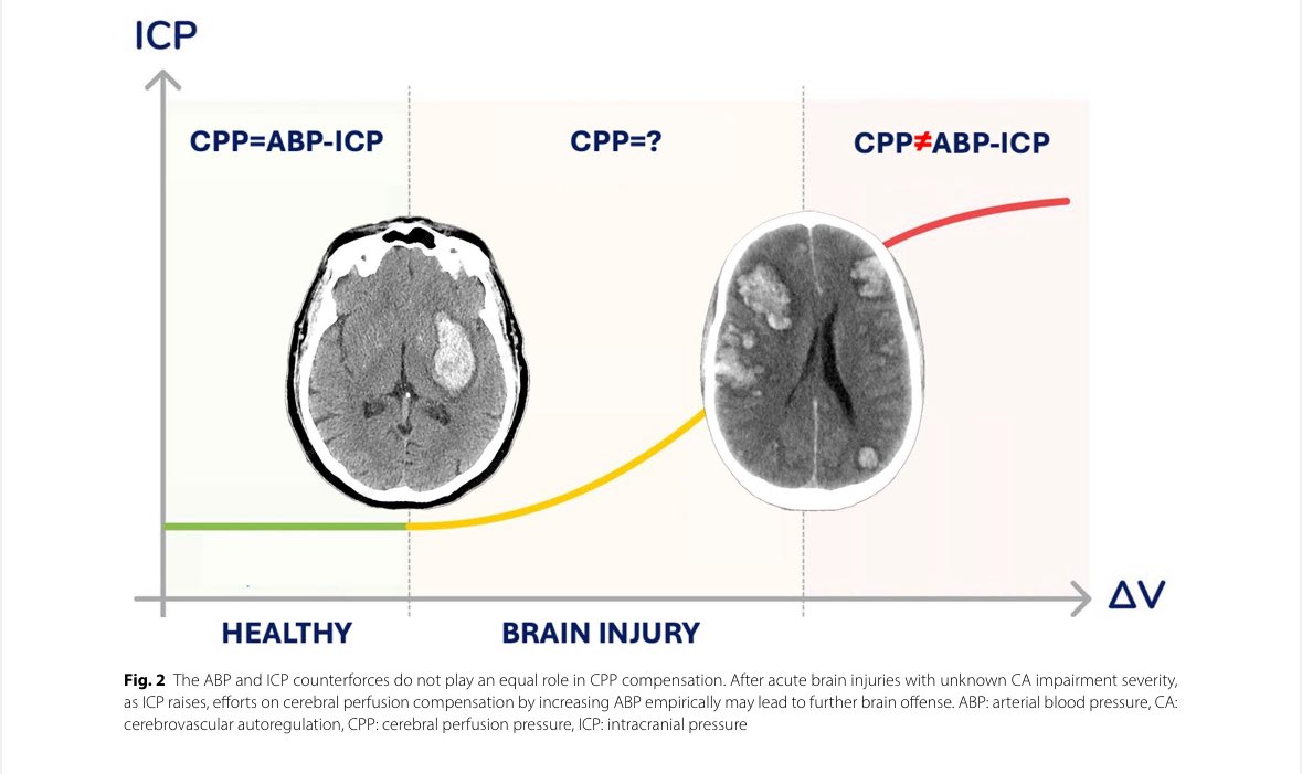EmergPOCUS's tweet image. 🧠 ¿Conoces la evolución del concepto de #Monro-Kellie?

             🔻Aquí te lo resumo 👇

📜 Monro-Kellie original (1783 - s. XX):

🧠 Dentro del cráneo rígido, el volumen total es constante:

🔹 Está compuesto por:
  • Tejido cerebral
  • Sangre
  • Líquido