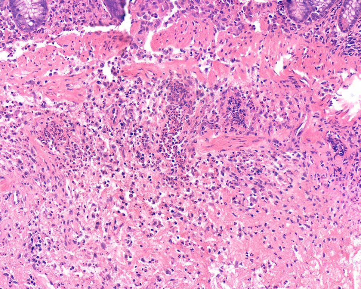 Surgical Pathology Cases tweet media