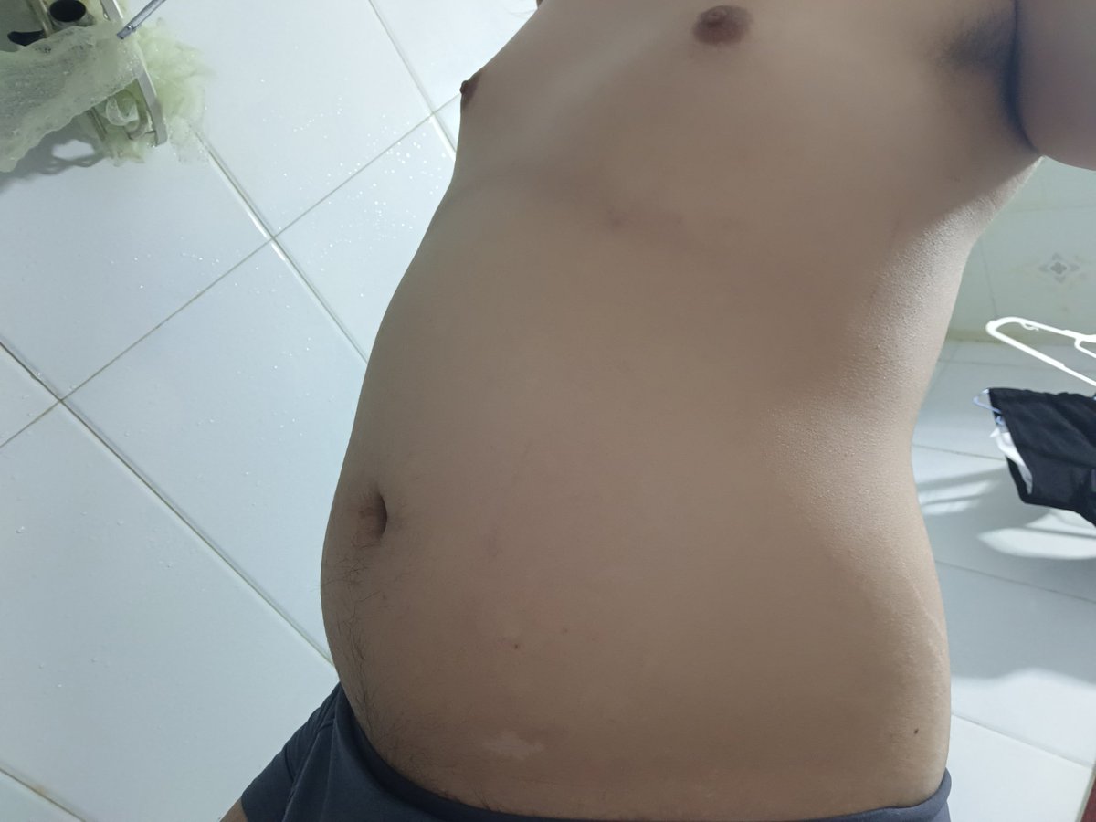 Mo_Rui_D_A's tweet photo. A big belly after dinner #bellyinflation #malebellyinflation #mpregbelly #bellyexpancion #inflatedbelly https://t.co/CPHnYi1Y7E