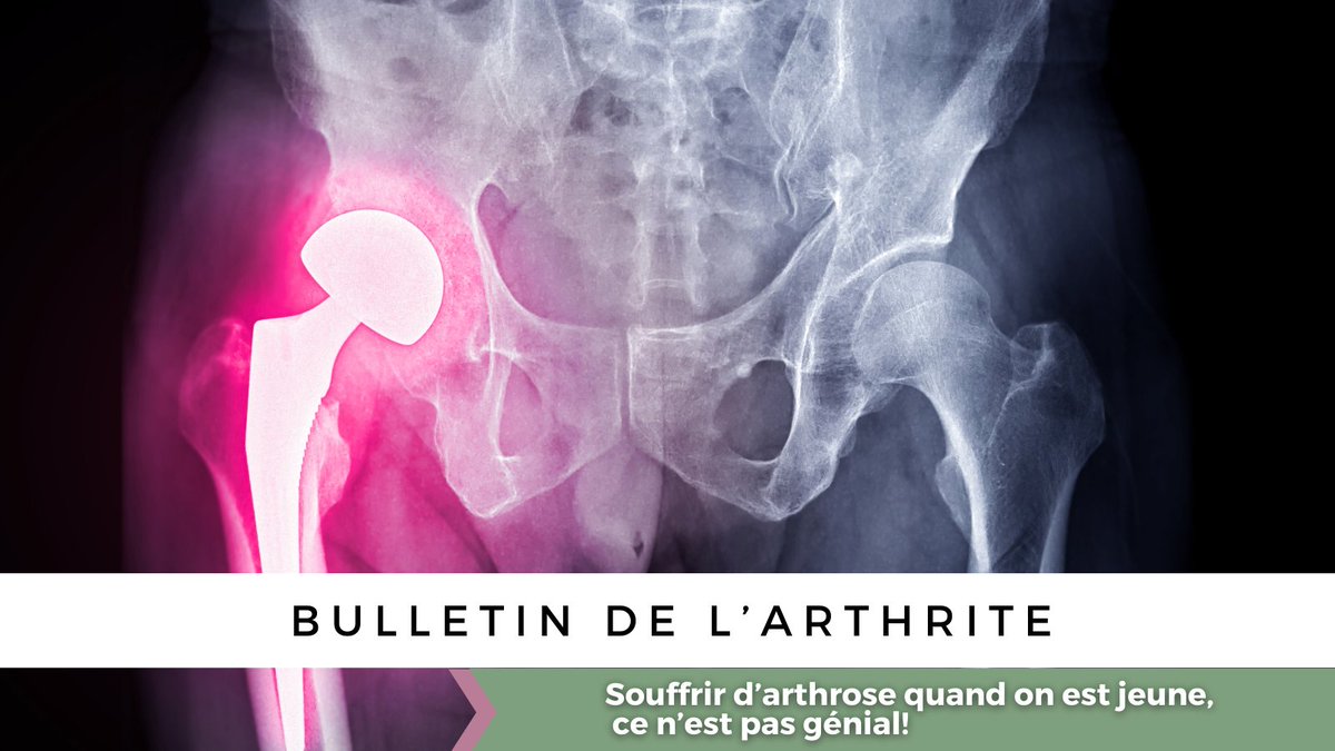Arthritis Research Canada (@arthritis_arc) on Twitter photo Plus de 100 000 chirurgies de remplacement de la hanche et du genou sont effectuées chaque année au Canada, surtout pour des personnes atteintes #d’arthrose. Pour en savoir plus : ow.ly/sR0O50VLEXt #ArthritisResearch <a href="/soarknee/">SOAR Knee</a> <a href="/jwhittak_physio/">Dr. Jackie Whittaker</a> <a href="/oaactionallianc/">OA Action Alliance</a> Plus de 100 000 chirurgies de remplacement de la hanche et du genou sont effectuées chaque année au Canada, surtout pour des personnes atteintes #d’arthrose. Pour en savoir plus : ow.ly/sR0O50VLEXt #ArthritisResearch <a href="/soarknee/">SOAR Knee</a> <a href="/jwhittak_physio/">Dr. Jackie Whittaker</a> <a href="/oaactionallianc/">OA Action Alliance</a>