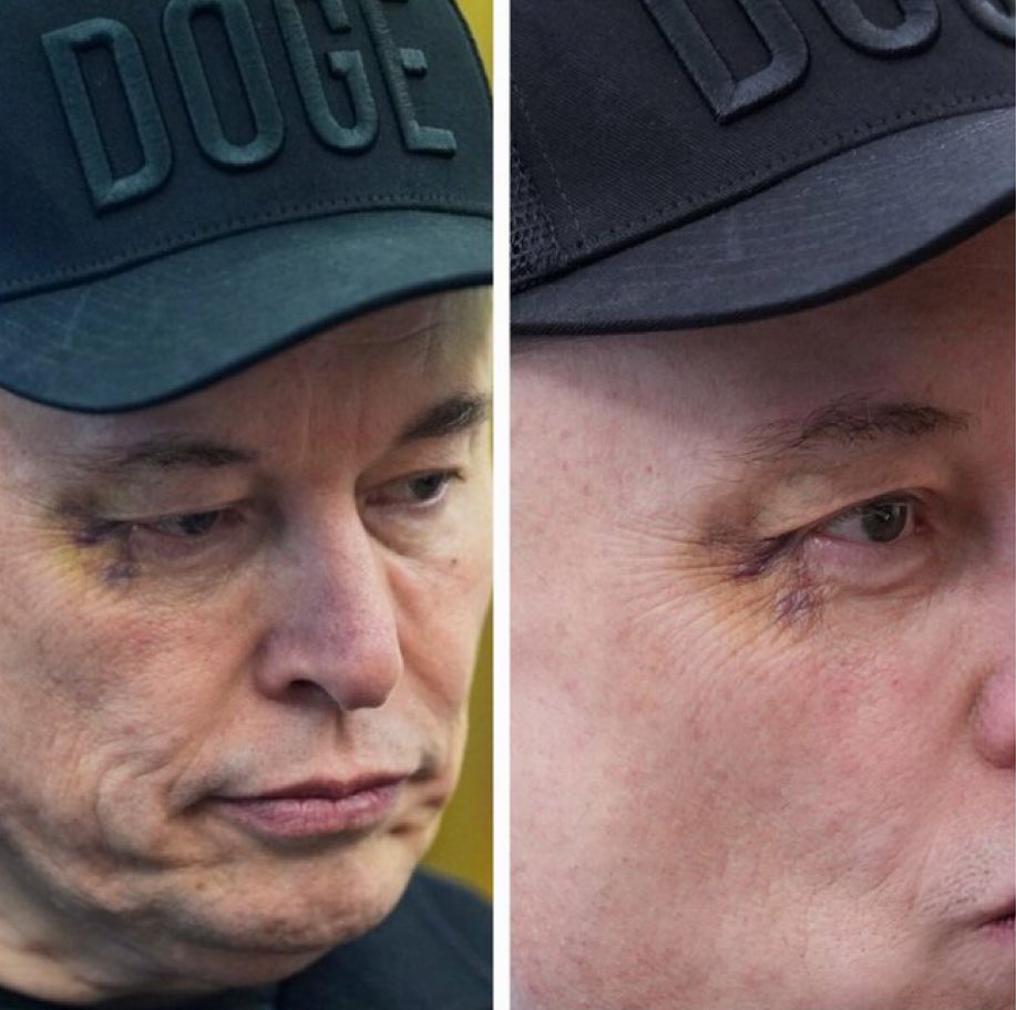 FreeThinkerFit's tweet photo. @rustyrockets People should be asking why Elon showed up to the White House with a black eye and the next week he is accusing Trump of being in the Epstein Files. https://t.co/4AoVlDnaXr