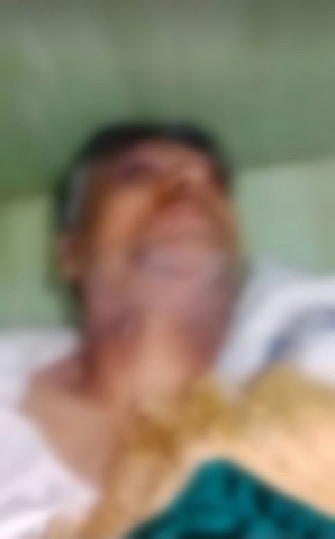 🔴 استشهاد مواطن علوي تحت التعذيب في ريف حمص

🔹ريف حمص | تلكلخ: استشهاد السيد حافظ يوسف الطويل، من قرية باروحة في منطقة تلكلخ، حيث قتل تحت التعذيب بعد خمسة أيام من اعتقاله من قبل عناصر الأمن العام الجهادي. 

🔹يذكر أن عدة محاولات جرت لمحاولة طرده من منزله لأجل الإستيلاء عليه من