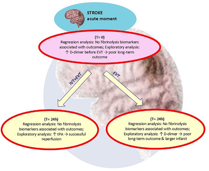 AshuJadhav (@ashupjadhav) on Twitter photo Association of Fibrinolysis With Acute Ischemic Stroke Outcome in Patients Undergoing Thrombectomy: Modification by Additional Administration of tPA? | Stroke: Vascular and Interventional Neurology ahajournals.org/doi/10.1161/SV… <a href="/StrokeAHA_ASA/">Stroke AHA/ASA</a> <a href="/svinsociety/">SVIN</a> <a href="/SVINJournal/">Stroke: Vascular and Interventional Neurology</a> Association of Fibrinolysis With Acute Ischemic Stroke Outcome in Patients Undergoing Thrombectomy: Modification by Additional Administration of tPA? | Stroke: Vascular and Interventional Neurology ahajournals.org/doi/10.1161/SV… <a href="/StrokeAHA_ASA/">Stroke AHA/ASA</a> <a href="/svinsociety/">SVIN</a> <a href="/SVINJournal/">Stroke: Vascular and Interventional Neurology</a>