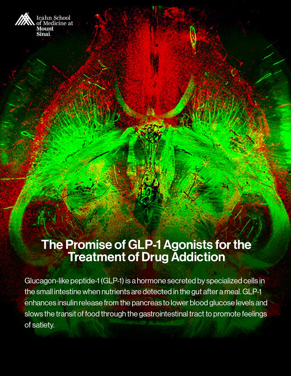Friedman Brain Institute (@sinaibrain) on Twitter photo OUT NOW➡️the Spring 2025 #FriedmanBrainInstitute newsletter👉reports.mountsinai.org/report/fbispri…
In this issue, learn about the promise of GLP-1 agonists for the treatment of drug addiction & the amazing work being done in the <a href="/PaulKennyPhD/">Paul Kenny, PhD</a> Lab.
reports.mountsinai.org/article/fbispr… OUT NOW➡️the Spring 2025 #FriedmanBrainInstitute newsletter👉reports.mountsinai.org/report/fbispri…
In this issue, learn about the promise of GLP-1 agonists for the treatment of drug addiction & the amazing work being done in the <a href="/PaulKennyPhD/">Paul Kenny, PhD</a> Lab.
reports.mountsinai.org/article/fbispr…