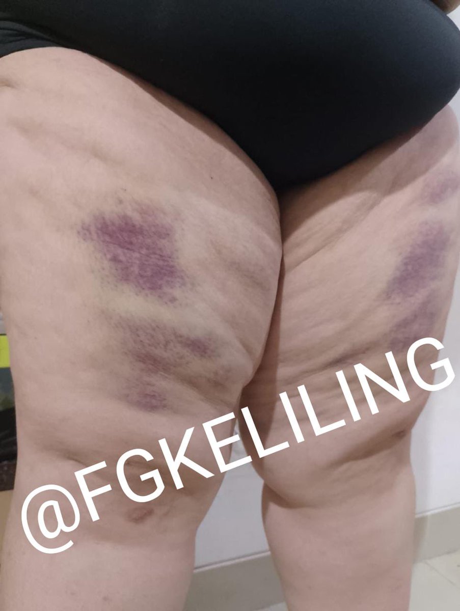 fgkeliling's tweet photo. Her body is my canvas @Rea13_dark 

@chansumomochan https://t.co/j9uG65xV4g