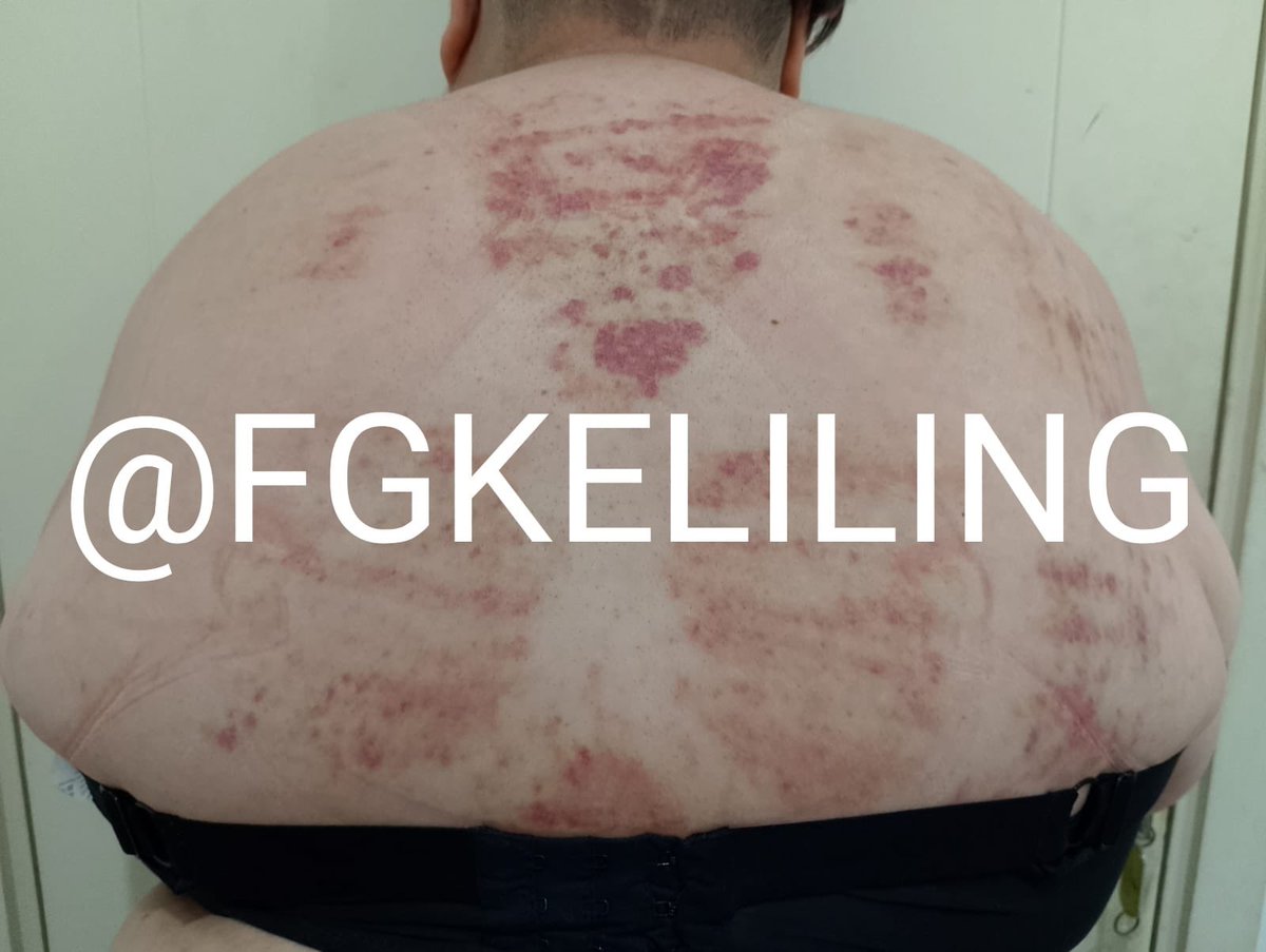 fgkeliling's tweet photo. Her body is my canvas @Rea13_dark 

@chansumomochan https://t.co/j9uG65xV4g