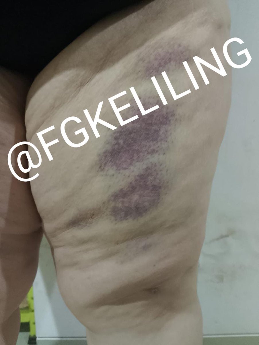 fgkeliling's tweet photo. Her body is my canvas @Rea13_dark 

@chansumomochan https://t.co/j9uG65xV4g