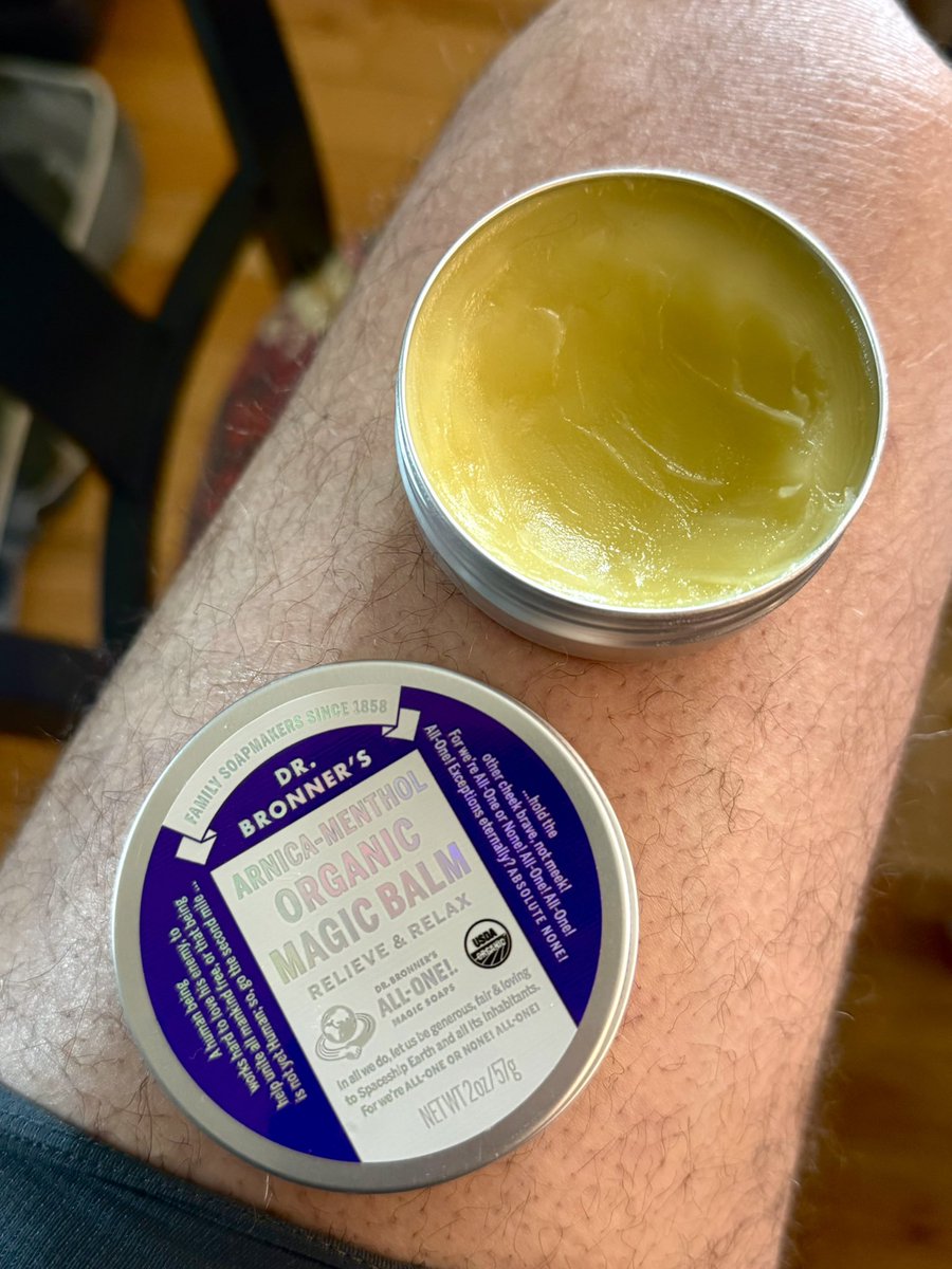 Centazzo's tweet photo. Willing to try anything to get this leg in working order. I’m even trying the advice of Dr Roast Beef Jay. This is some serious balm.
#WhateverItTakes
#TeamKMS
#ForCinema https://t.co/4uUM8QexMj