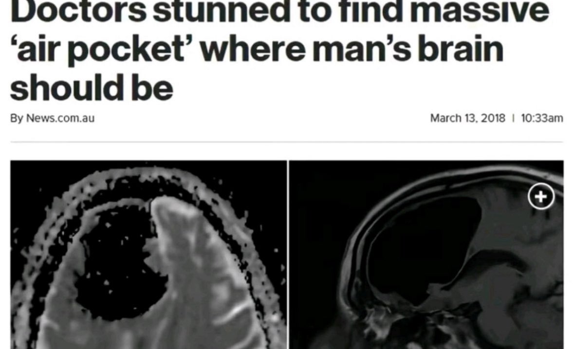 Notmattewballeekahoot2 tweet media