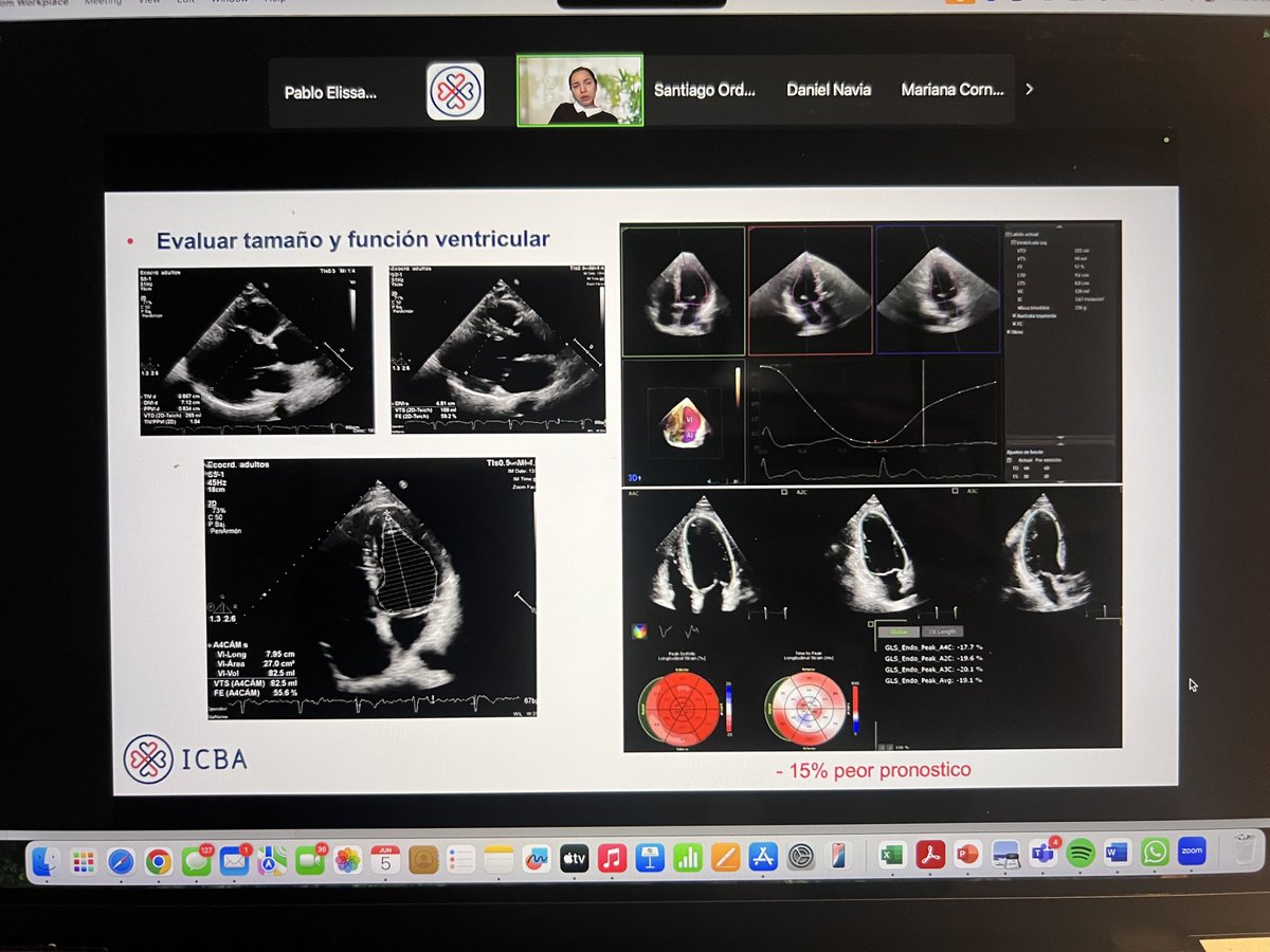 Pablo Elissamburu 🇦🇷 (@pfelissamburu) on Twitter photo Insuficiencia Aórtica ¿qué debemos evaluar por eco hoy? <a href="/ICBAonline/">ICBA Instituto Cardiovascular</a> ahora!!! Insuficiencia Aórtica ¿qué debemos evaluar por eco hoy? <a href="/ICBAonline/">ICBA Instituto Cardiovascular</a> ahora!!!