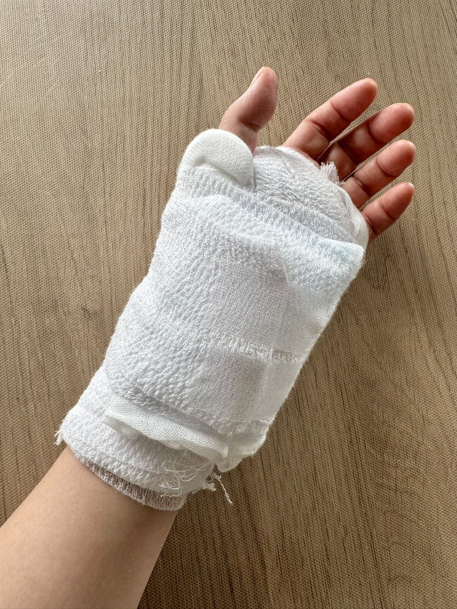 手根管開放手術を内視鏡でしてきました。麻酔が効いているからモワッとしてますが明日の朝には包帯取っていいそう。早い❗️