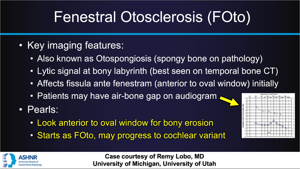 ASHNR (@ashnrsociety) on Twitter photo #ASHNRCOTW #300*: ANSWER. Thx
<a href="/remyrlobo/">Remy Lobo</a> 4 case! #ASHNR25
<a href="/callyrobs/">Caroline Robson, MBChB</a> <a href="/DShatzkes/">Deborah Shatzkes</a> <a href="/CDP_Rad/">C Douglas Phillips 🇺🇸</a> <a href="/rhwiggins/">Richard Wiggins</a>
<a href="/nakoontz/">Nicholas Koontz</a> <a href="/KRileyMD/">Kalen Riley</a> <a href="/CMGlastonbury/">Christine M Glastonbury, MD</a> <a href="/tabby_kennedy/">Tabby A. Kennedy, MD</a> <a href="/PhilipRChapman1/">Philip R. Chapman, MD</a> <a href="/cmtomblinson/">Courtney Tomblinson, MD</a>
<a href="/amyfjuliano/">Amy Juliano</a> <a href="/bpoliceni/">Bruno Policeni</a> <a href="/MohitTCCNeuro/">Mohit Agarwal</a> <a href="/AshokSrini15/">Ashok Srinivasan</a> <a href="/KatieTraylorDO/">Katie S. Traylor MS, DO, DABR</a> <a href="/CynXinWu/">Cynthia Xin Wu</a> #ASHNRCOTW #300*: ANSWER. Thx
<a href="/remyrlobo/">Remy Lobo</a> 4 case! #ASHNR25
<a href="/callyrobs/">Caroline Robson, MBChB</a> <a href="/DShatzkes/">Deborah Shatzkes</a> <a href="/CDP_Rad/">C Douglas Phillips 🇺🇸</a> <a href="/rhwiggins/">Richard Wiggins</a>
<a href="/nakoontz/">Nicholas Koontz</a> <a href="/KRileyMD/">Kalen Riley</a> <a href="/CMGlastonbury/">Christine M Glastonbury, MD</a> <a href="/tabby_kennedy/">Tabby A. Kennedy, MD</a> <a href="/PhilipRChapman1/">Philip R. Chapman, MD</a> <a href="/cmtomblinson/">Courtney Tomblinson, MD</a>
<a href="/amyfjuliano/">Amy Juliano</a> <a href="/bpoliceni/">Bruno Policeni</a> <a href="/MohitTCCNeuro/">Mohit Agarwal</a> <a href="/AshokSrini15/">Ashok Srinivasan</a> <a href="/KatieTraylorDO/">Katie S. Traylor MS, DO, DABR</a> <a href="/CynXinWu/">Cynthia Xin Wu</a>