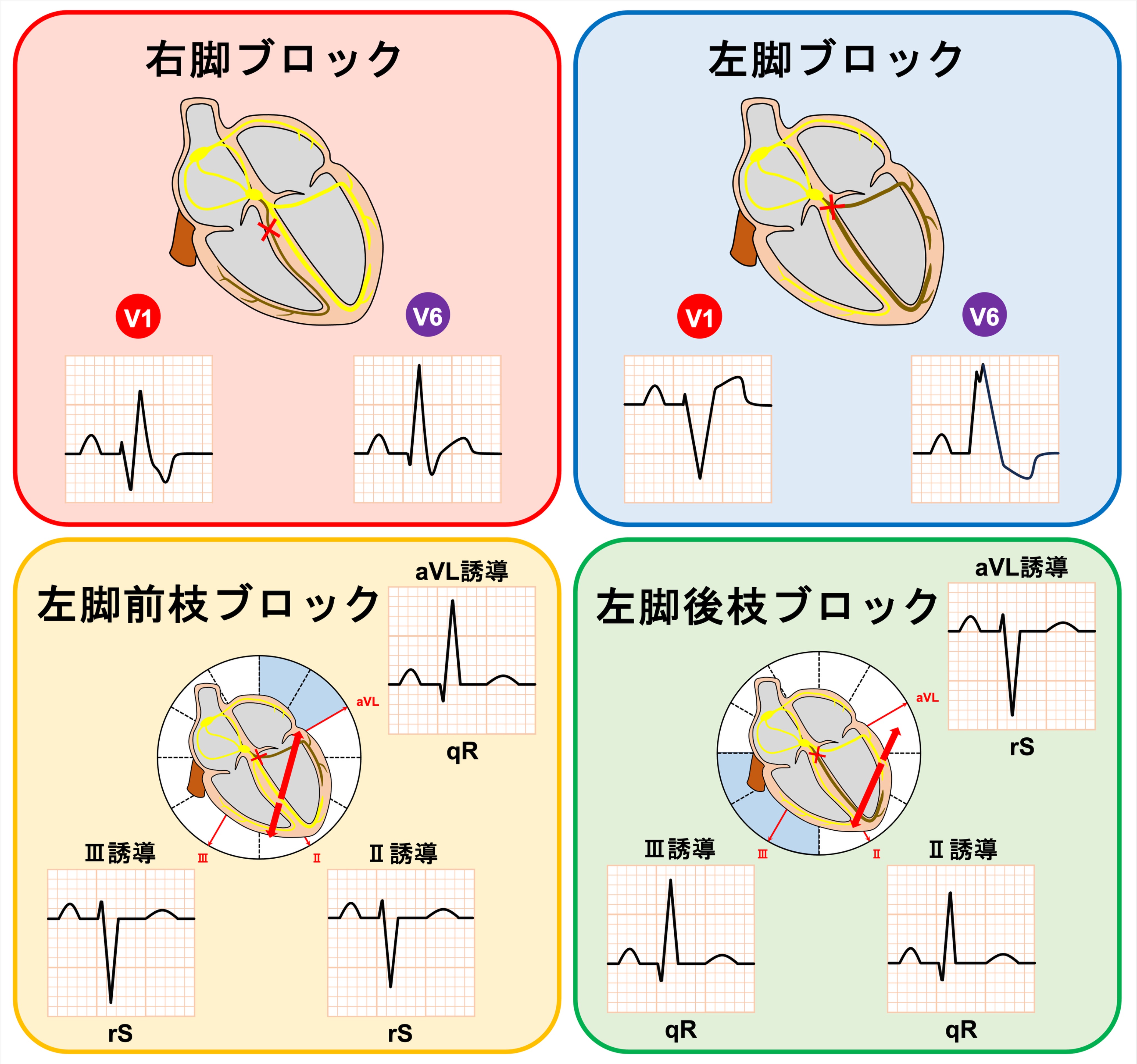 ケロッピ☆様 Amazon.co.jp: けろけろけろっぴ リュックサック 大容量 通勤