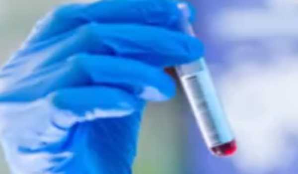 Kerala: Amid rising COVID cases, risks of monsoon diseases loom large goachronicle.com/kerala-amid-ri…