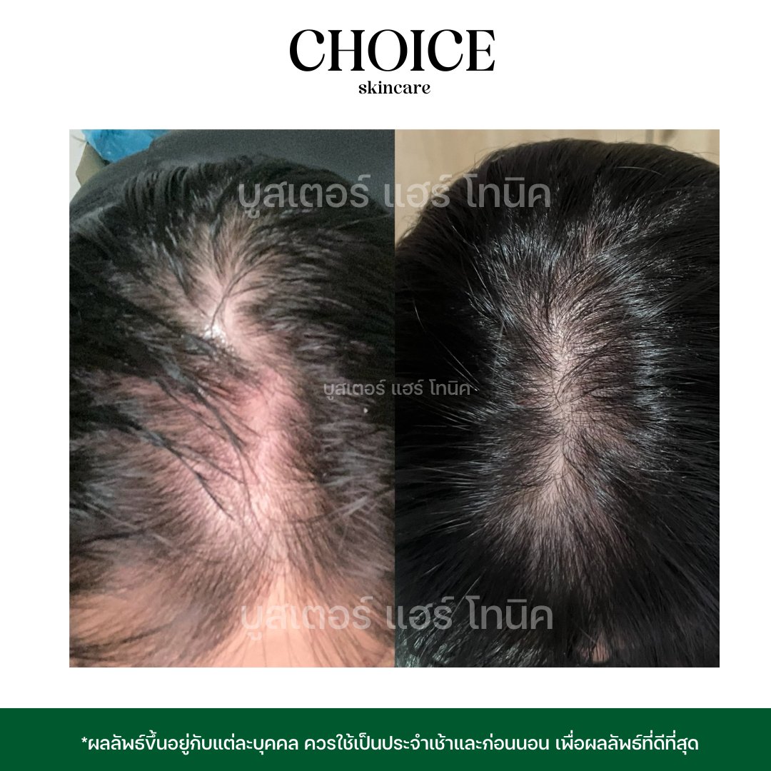 CHOICE SKINCARE CEO 🔺 tweet media