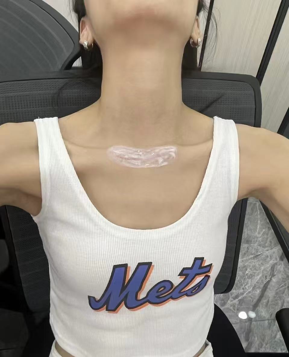 JheneShema89759's tweet image. ✨ Say goodbye to stubborn scars!
Whether it’s from a C-section, eyelid surgery, or other procedures—our Scar Care Patches are designed to fade scars, smooth skin, and support gentle healing. 
 Trusted by thousands, backed by clinical evidence.
#SiliconePatch
#WoundCare
#Scar