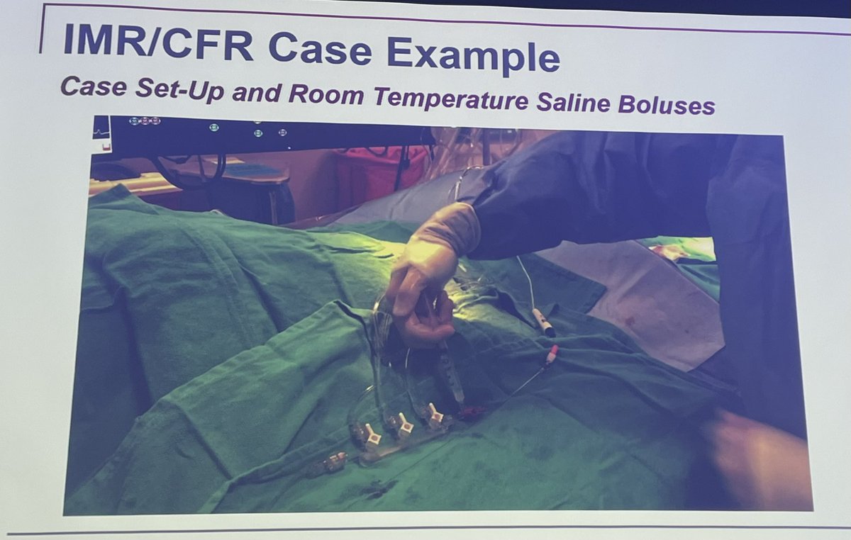 Mona Tirén (@monaltiren) on Twitter photo #CoronaryPhysiology
#CoronaryThermodilution
#MicrovascularFunction
MEET THE RESEARCHER
behind
Index of Microcirculatory Reserve
( I M R )
<a href="/wfearonmd/">William Fearon</a> #CoronaryPhysiology
#CoronaryThermodilution
#MicrovascularFunction
MEET THE RESEARCHER
behind
Index of Microcirculatory Reserve
( I M R )
<a href="/wfearonmd/">William Fearon</a>