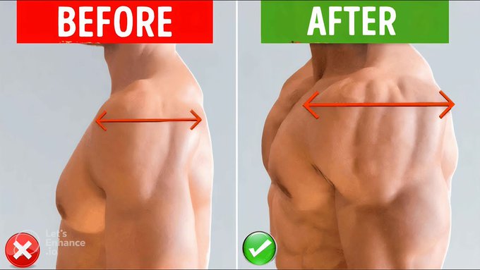 theoliveranwar's tweet image. The workout no one is talking about:  

Shoulder day.  

I’ve helped 100s of people grow their shoulders.  

Here are the only 5 exercises you need for massive shoulders (bookmark this):