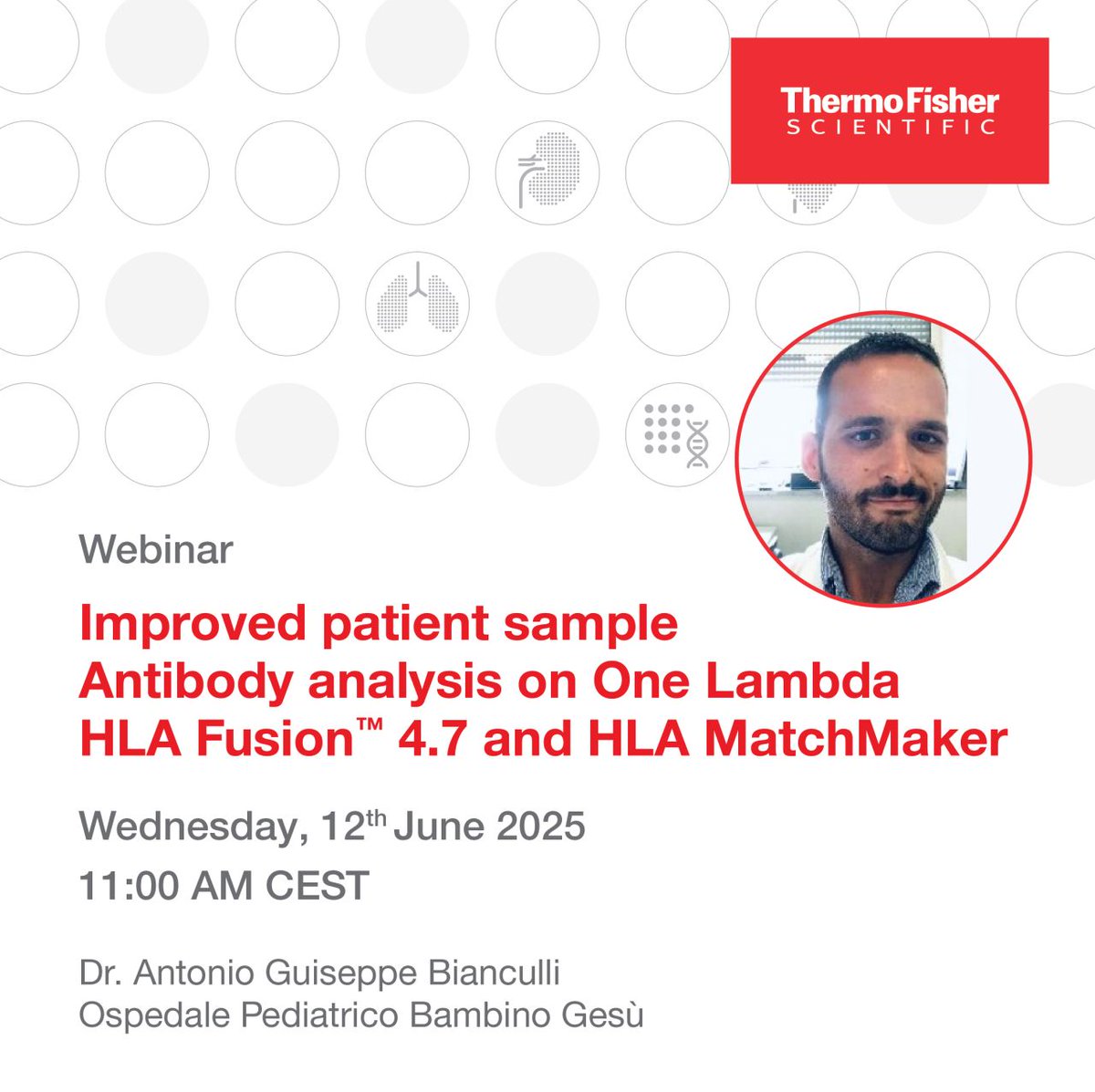 VHBio (@vhbio) on Twitter photo Catch <a href="/OneLambda/">One Lambda | A Thermo Fisher Scientific Brand</a>'s webinar:
“Improved patient sample Antibody analysis on One Lambda™ HLA Fusion 4.7 and HLA MatchMaker” next week!
Learn more and register: event.on24.com/wcc/r/4944155/… Catch <a href="/OneLambda/">One Lambda | A Thermo Fisher Scientific Brand</a>'s webinar:
“Improved patient sample Antibody analysis on One Lambda™ HLA Fusion 4.7 and HLA MatchMaker” next week!
Learn more and register: event.on24.com/wcc/r/4944155/…