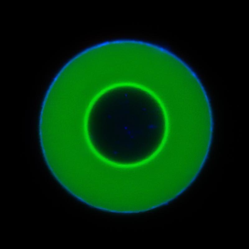 Informationsdienst Wissenschaft - Nachrichten (@idw_online_de) on Twitter photo Forschende der JGU entdecken bisher unbekannte Art der MolekĂĽlbewegung
Forschende der Johannes Gutenberg-Universität Mainz, des Max-Planck-Instituts für Polymerforschung und der University of Texas at Austin haben eine bislang unbekannte Art der Molekü
nachrichten.idw-online.de/2025/06/06/for… Forschende der JGU entdecken bisher unbekannte Art der Molekülbewegung
Forschende der Johannes Gutenberg-Universität Mainz, des Max-Planck-Instituts für Polymerforschung und der University of Texas at Austin haben eine bislang unbekannte Art der Molekü
nachrichten.idw-online.de/2025/06/06/for…